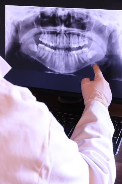 Best Emergency Tooth Extraction in Woodstock, VA
